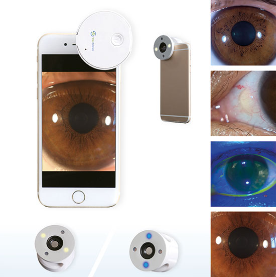 Smartphone Eye Imaging Adapter