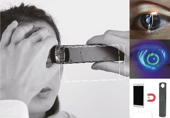 Tragbare Hanspaltlampe S150 von Mediworks bei Jen-Ophthalmo